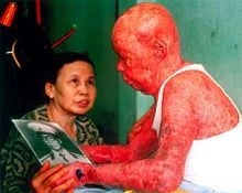 Ancien militaire vietnamien tenant une photo de lui-même avant sa contamination par l'Agent Orange